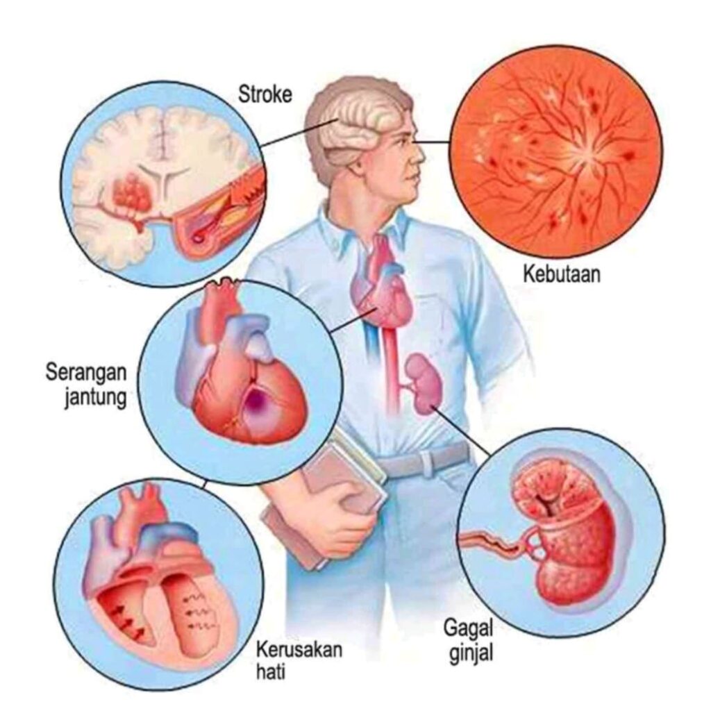 Skrining Komplikasi Organ Pendekatan Moderen Untuk Deteksi Dini Penyakit Kronis