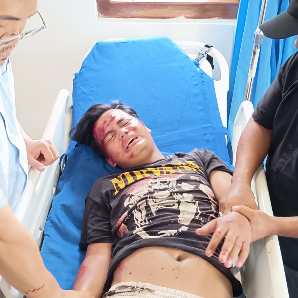 Belum Lama Diperbaiki, Jalan Sungai Mengkuang Kembali Memakan Korban